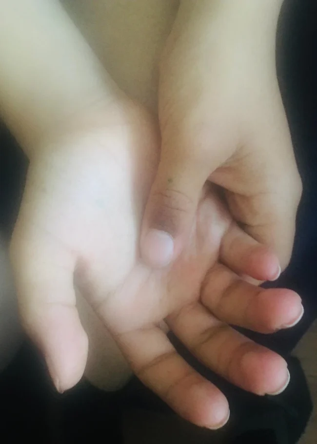 Hand reflexology